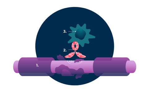 Bottom image left: Illustration of macrophage recruitment during an immune response. It shows an IgG antibody anchored to the myelin sheath.